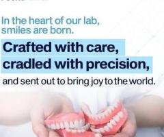 Full metal restorations