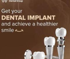 CEREC Crowns Claremont