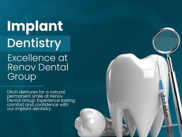 Root Canals in Claremont