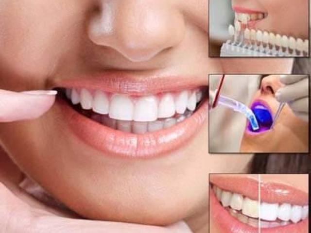 Specialized Dentistry Programs in Whittier