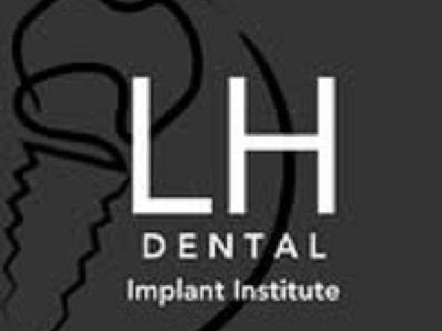 All On Implants Service in Whittier, Ca