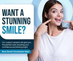 Dental Veneers in Claremont
