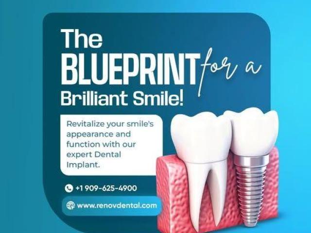 Smile Makeover in Claremont