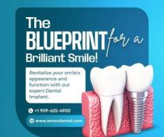 Smile Makeover in Claremont