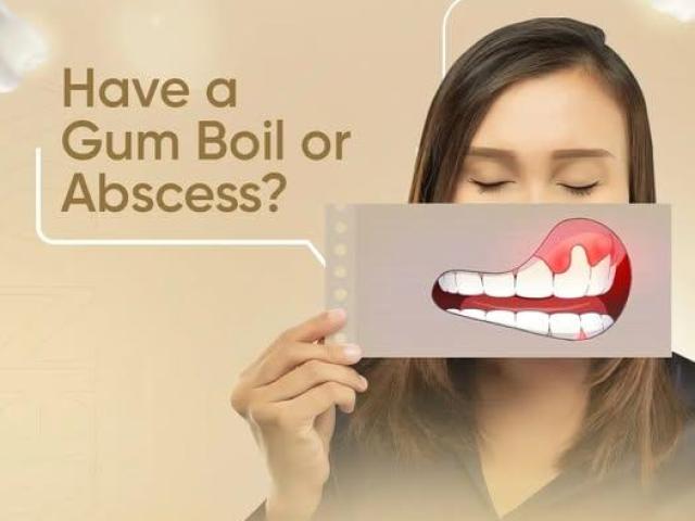 Full Mouth Reconstruction Claremont