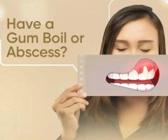 Full Mouth Reconstruction Claremont