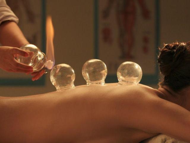 Cupping Therapy Burlingame, CA