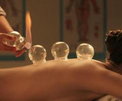 Cupping Therapy Burlingame, CA