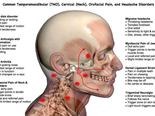 Temporomandibular Joint Disorder Care in Minnesota