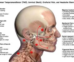 Temporomandibular Joint Disorder Care in Minnesota