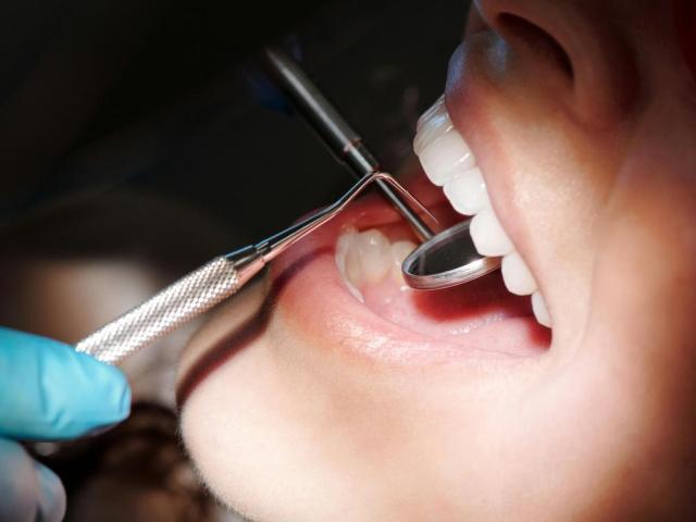 Top-quality dental services Buena Park