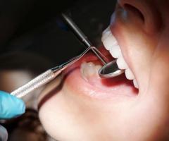 Top-quality dental services Buena Park