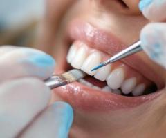 Top Notch Dental Care in Palo Alto