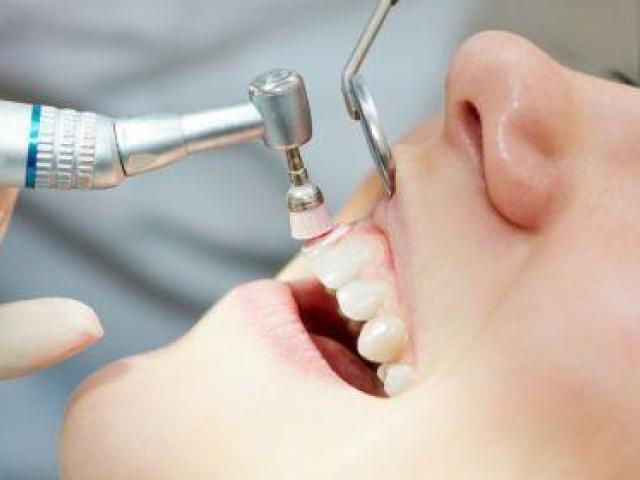 Veneer Treatment Service in Foster City