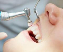 Veneer Treatment Service in Foster City