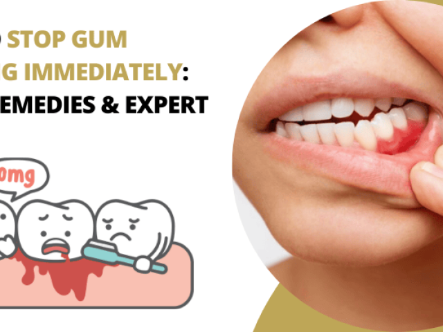 Tooth Implant Dentist in Foster City