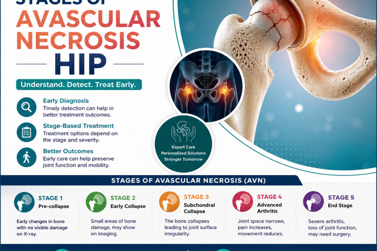 Stages of Avascular Necrosis Hip - HipXpert 1 tumblr 998888529cd5cc2d0bae9cbe21897f72 7a1c6984 1280
