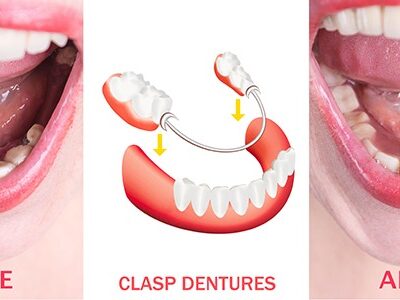 Emergency Dental Service
