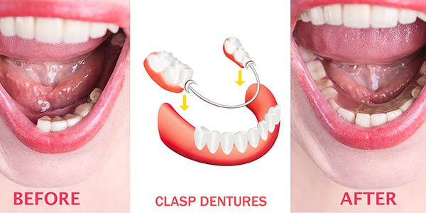 Emergency Dental Service