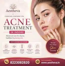 acne treatment in indore aestheva indore 1584177363