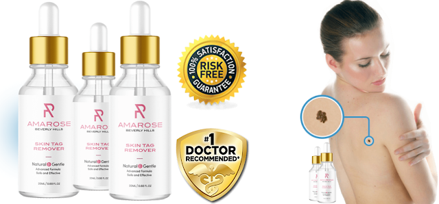 Amarose Skin Tag Remover Reviews: FAKE customer complaints, best mole removal