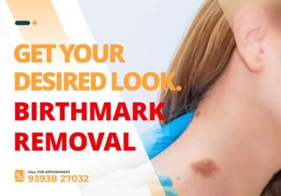birth-removal