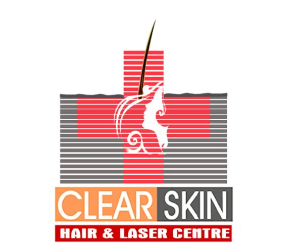 best vascular laser treatment in india