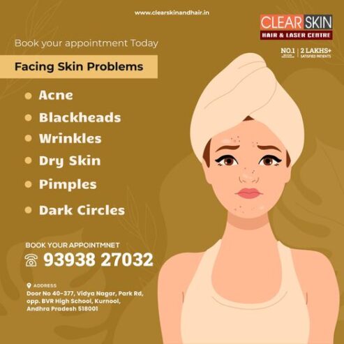 vbeam laser treatment in hyderabad