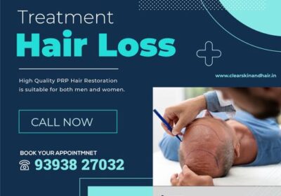 hair-loss-trmt