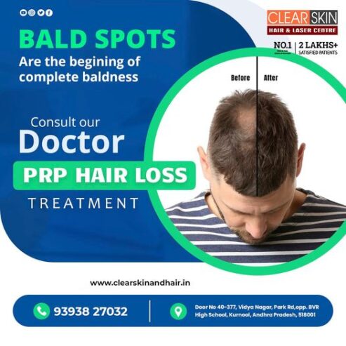 best Advanced PRP hair Treatment in india