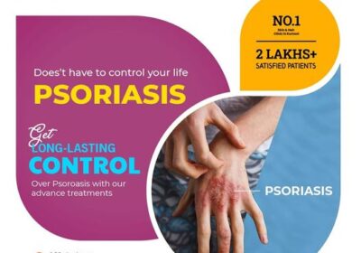 psoriasis-1