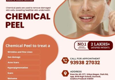 chemical-peel