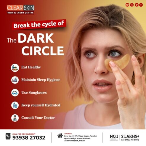 Best VBeam Prima treatment in Kurnool Laser Treatment