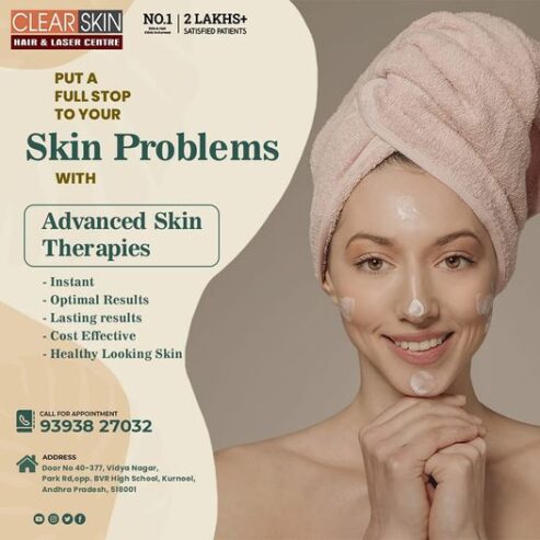 Advance Treatment For Birthmark Removal In India || Laser Treatment || Skin Care Painfree || Clearskin and Haircare Kurnool
