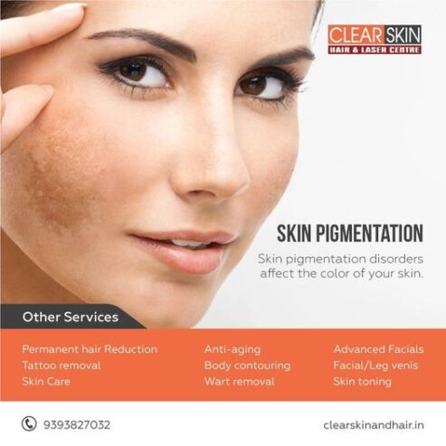 Psoriasis Treatment in hyderabad