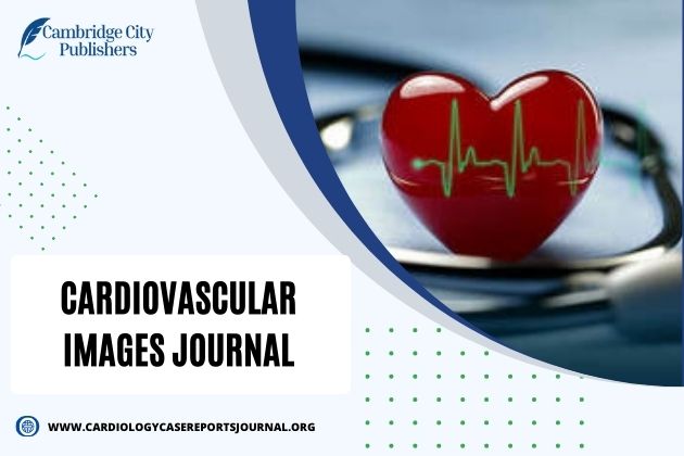 Journal of Cardiac Imaging – Cambridge Publishers