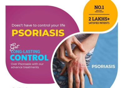 clear-skin-2-psoriasis