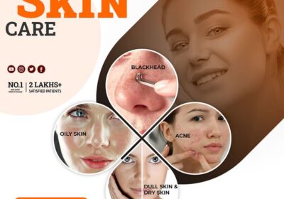 clear-skin-41