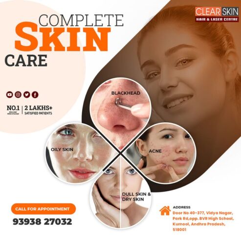 pulsed dye laser treatment in bangalore
