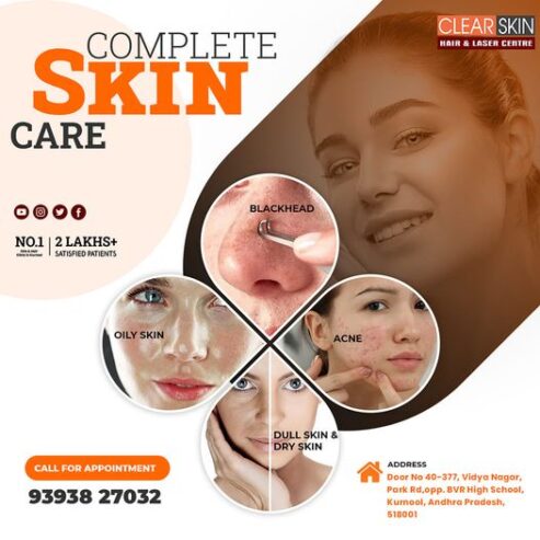 portwine stain treatment in Andhra Pradesh AP