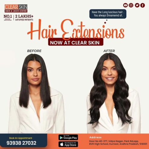 Mesotherapy hair Treatment in hyderabad