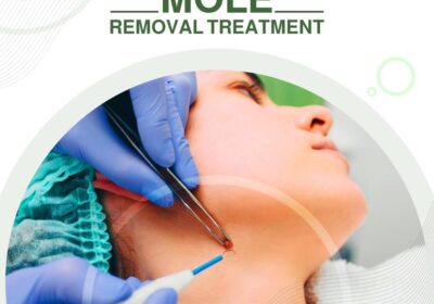 clear-skin-27-mole-removal