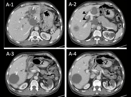 Clinical Medicine Journal: Imaging and Case Reports