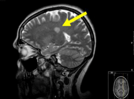 Clinical-Imaging-Journal-PubMed