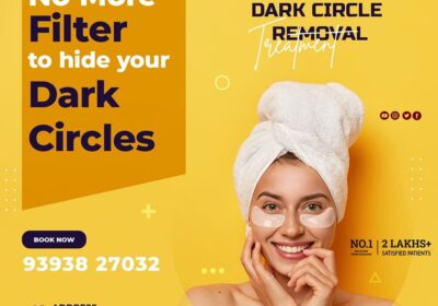 dark-circles-2