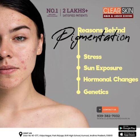 Laser treatment clinic in india