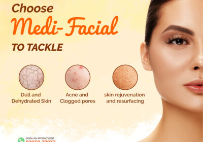 Facial