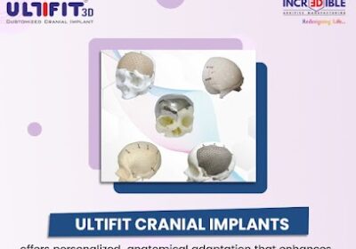3d-medical-ultifit-cranial-implant