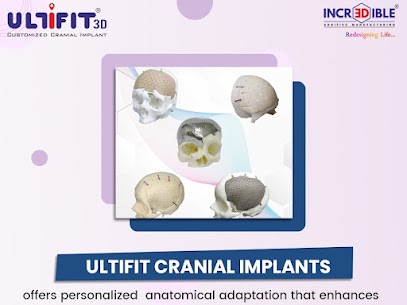 patient-specific cranial implants by 3Dincredible